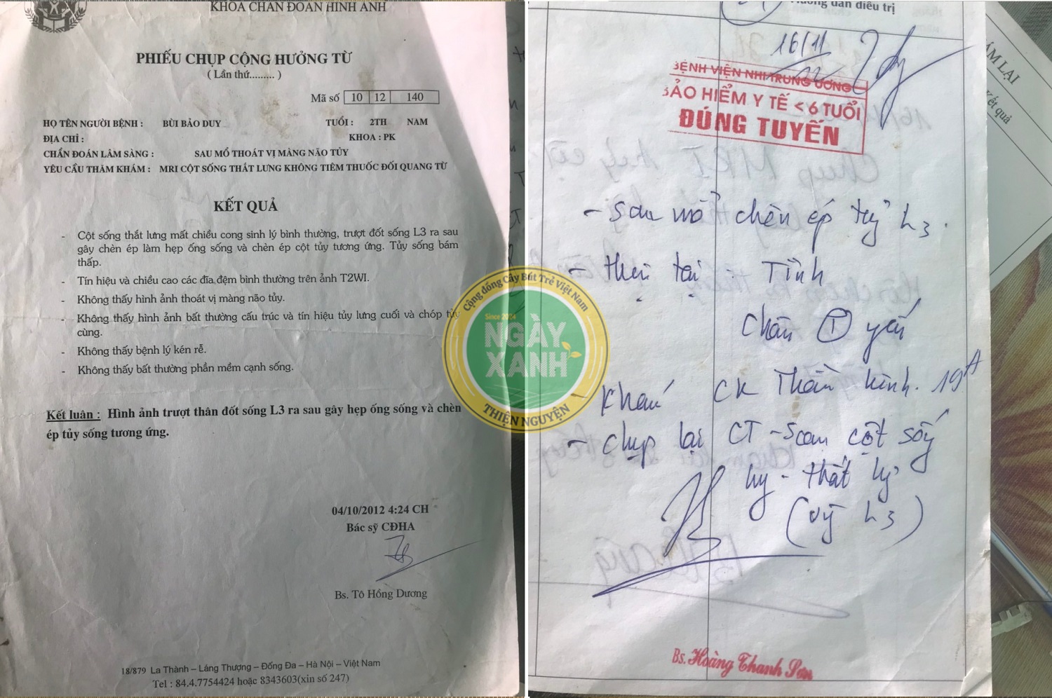 Hồ sơ bệnh án Bùi bảo Duy, em học sinh lớp 6 ở huyện Vụ Bản (Nam Định) với bệnh liệt từ nhỏ đã từng đi qua các ca phẫu thuật và điều trị ở các bệnh viện lớn.