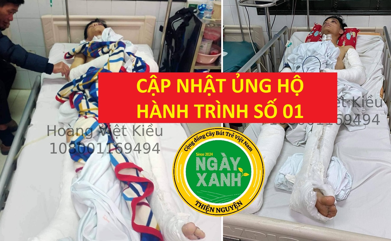 Cập nhật các thông tin hỗ trợ, ủng hộ, giúp đỡ từ bạn bè, anh em, đồng nghiệp và các nhà hảo tâm qua thông tin kêu gọi của CLB thiện nguyện Ngày Xanh.
