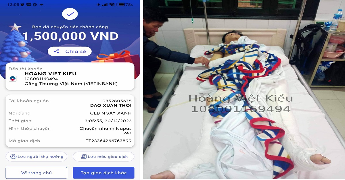 CLB thiện nguyện Ngày Xanh đã chuyển gửi số tiền hỏi thăm ủng hộ của một số nhà hảo tâm đến với bạn Hoàng Bảo Quỳnh