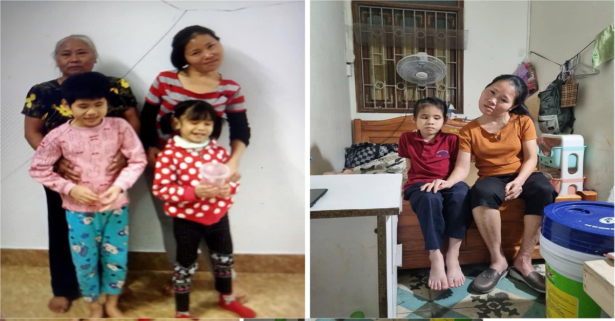 Hàn cảnh của chị Nguyễn Thị Thúy bị bại não từ nhỏ. Di chứng ấy khiến đầu của chị bây giờ cứ phải nghẹo sang một bên.